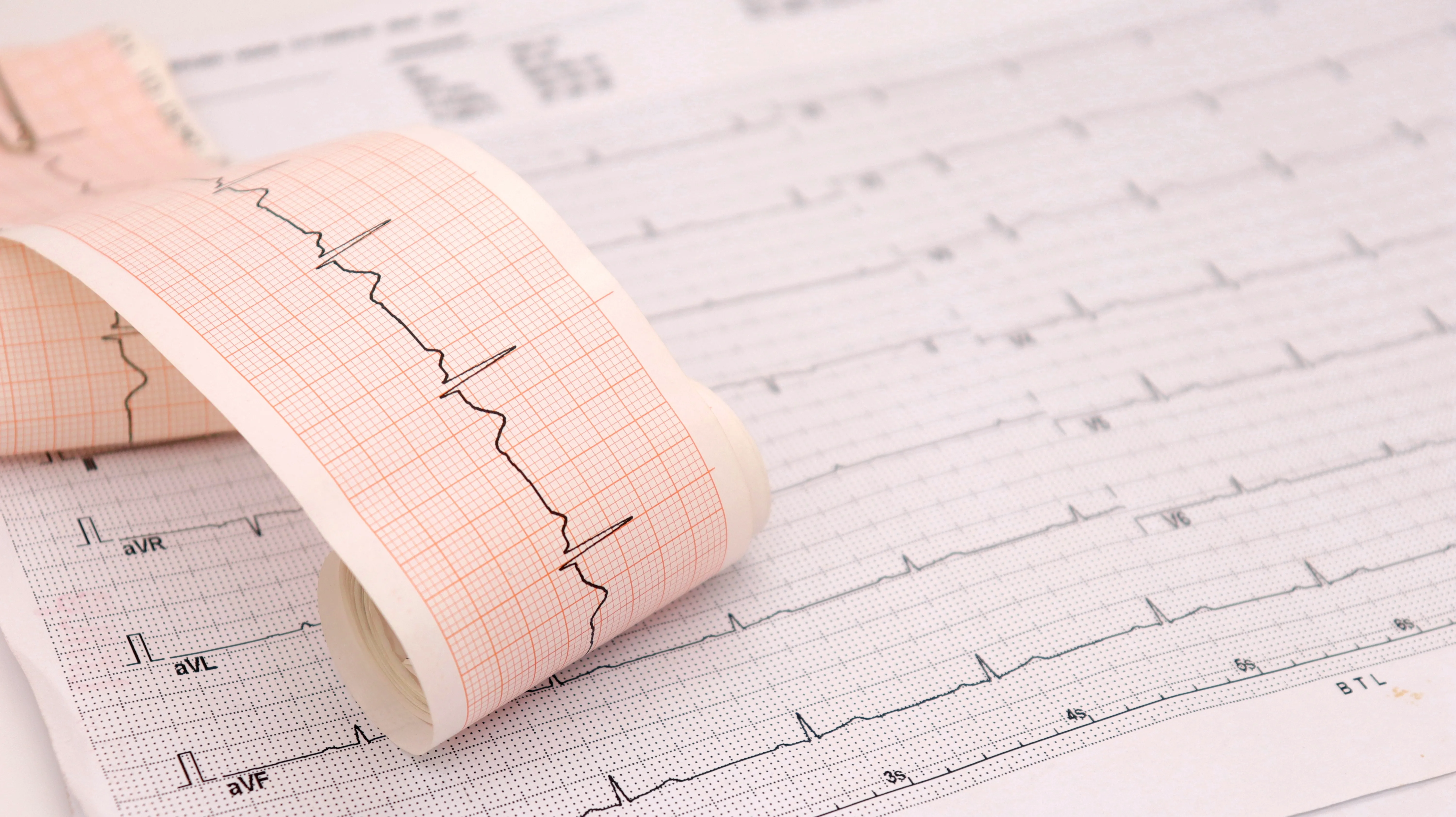 heart rhythm ekg note on paper doctors use to analyze heart disease treatment illustration