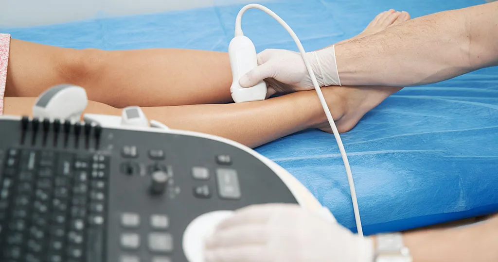 Ultrassom Vascular de Membros Inferiores em Macapá
